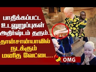 பணத்துக்காக குடும்ப உறவுகளே செய்யும் கொடூர மனித வேட்டை! #ShockingFacts