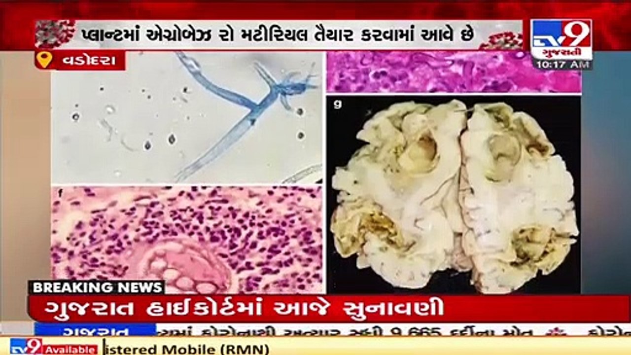 Production capacity of raw materials used for manufacturing Amphotericin B ramped-up _ TV9News