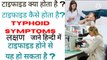 टाइफाइड क्या होता है?,Typhoid कैसे होता है, Typhoid Symptoms,टाइफाइड  लक्षण हिन्दी में,टाइफाइड बचाब,