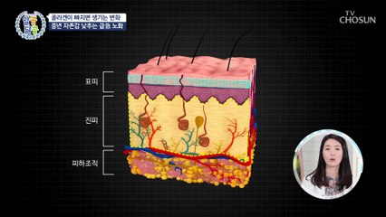 몸속에 콜라겐이 빠지게 되면 걸리는 각종 질병들☠ TV CHOSUN 20210527 방송