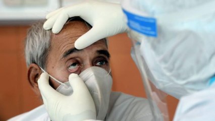 Black Fungus cases pile up in several states, know update