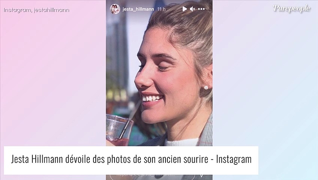 Jesta Hillmann débarrassée d'un gros complexe : elle a succombé à une tendance esthétique