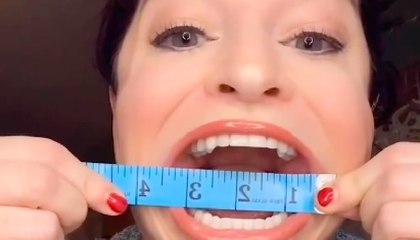 Samantha Ramsdell: la mujer que se hizo famosa por el gran tamaño de su boca