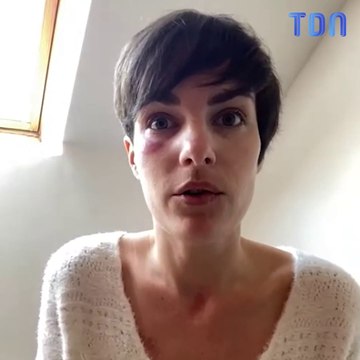 « Elle a le triste surnom de la maladie du suicide » : Diane, atteinte d’algie vasculaire de la face, se confie sur cette terrible maladie