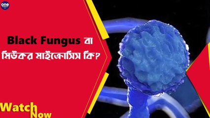 ব্ল্যাক ফাঙ্গাস বা মিউকর মাইক্রোসিস কি? | Oneindia Bengali