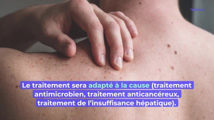 Pétéchies : faut-il s'inquiéter