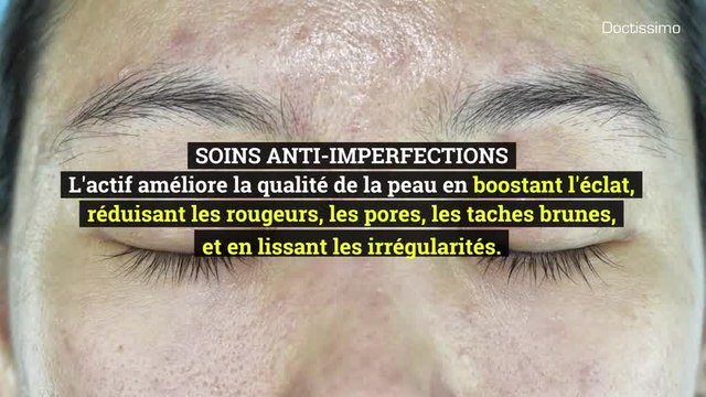 Ingrédients cosmétiques - La niacinamide