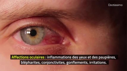 Phytothérapie - Fenouil