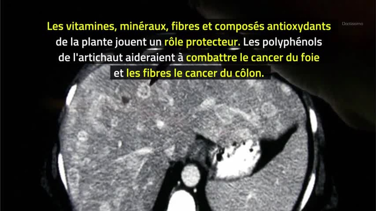 Phytothérapie - Artichaut