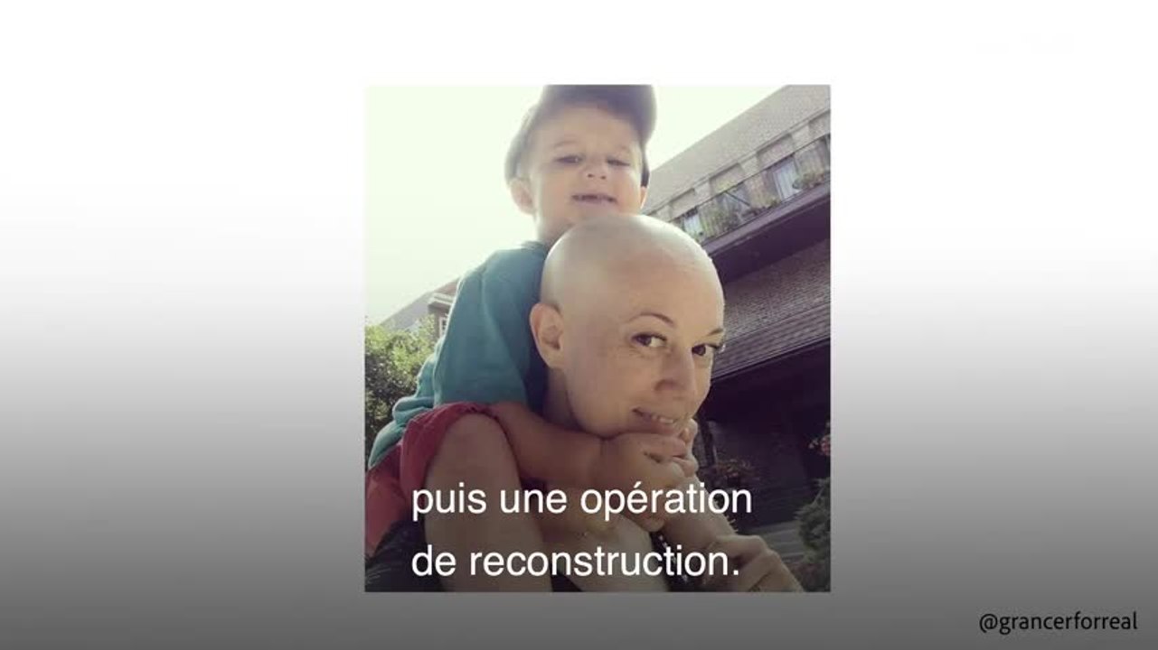 Tatouage sur mastectomie