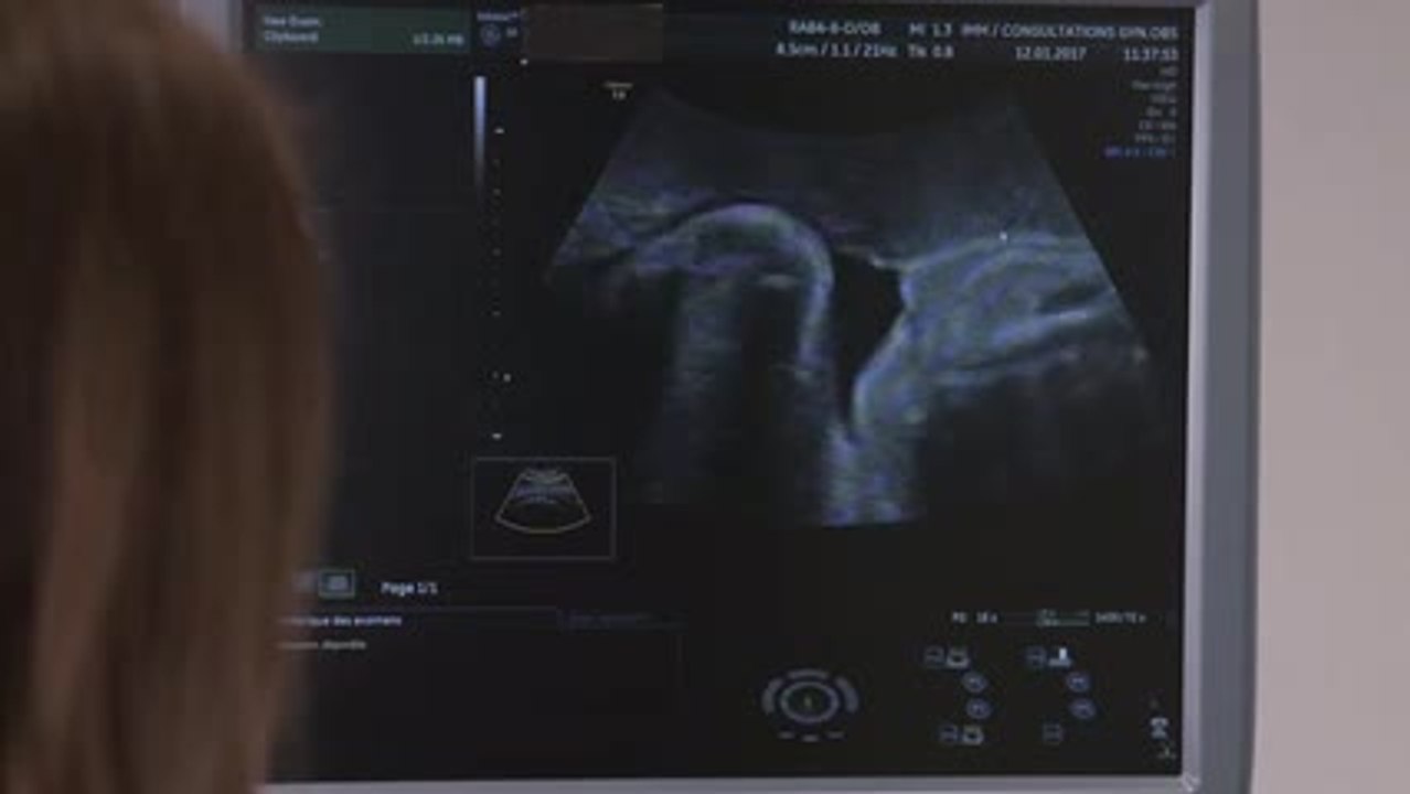 La 3e échographie de grossesse