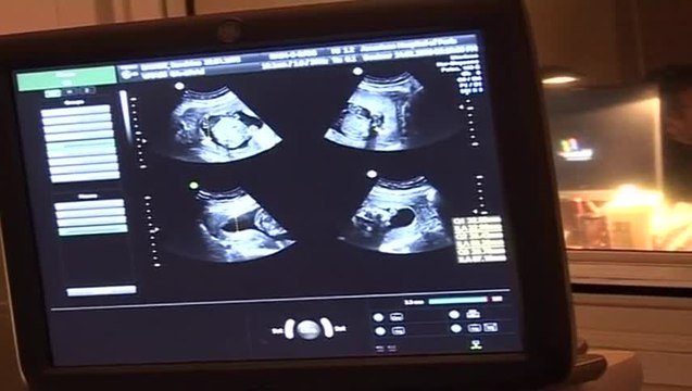 Les échographies de la grossesse en images