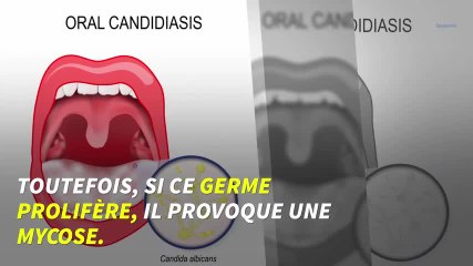 La cigarette électronique favorise les champignons dans la bouche