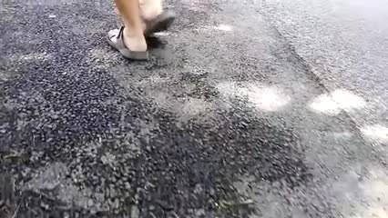 Crevasses aux pieds : que faire