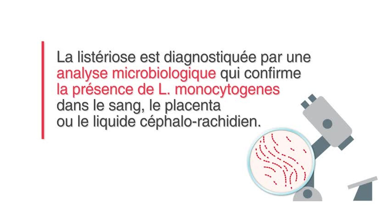 Infection à listeria : qu’est-ce que c’est