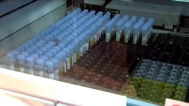 Le parcours d’un tube de sang au laboratoire de biologie médicale