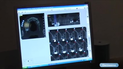 Bien préparer la pose d'un implant (radiologie, anesthésie)