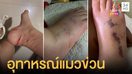 อุทาหรณ์สาวโดนแมวข่วน แบคทีเรียกินเนื้อ เท้าเกือบเน่า | ข่าวเที่ยงอมรินทร์ | 29 พ.ค.64