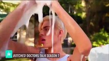 'Botched' Doctors Reveal Some Of This Season's Strangest Cases