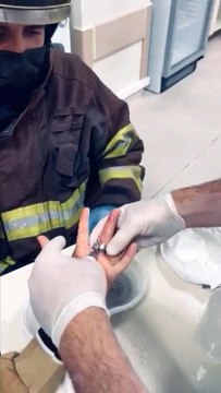 Son dakika haberi... Parmağına sıkışan yüzüğü itfaiye ekipleri keserek çıkarttı