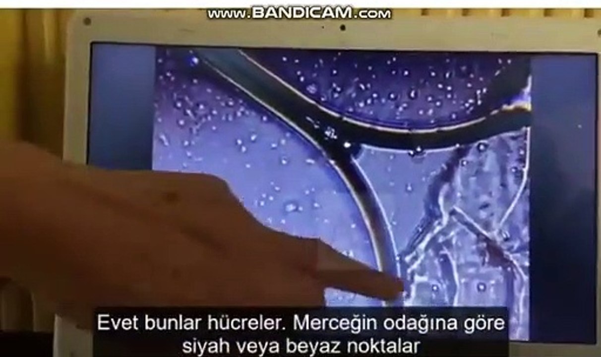 mRNA aşıları 20.000x bütülmüş hali