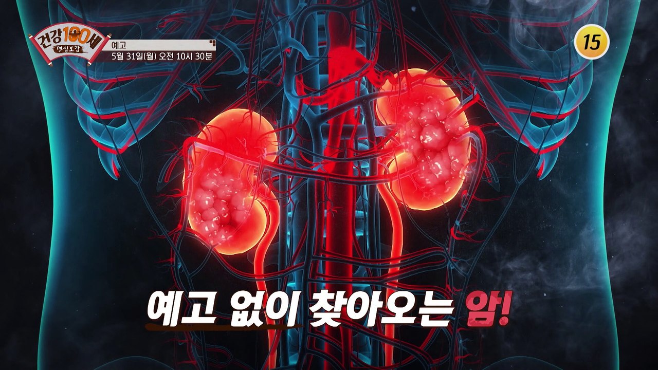 관절염 타파! 내 무릎으로 평생 사는 비법 대공개!_명심보감 41회 예고 TV CHO...