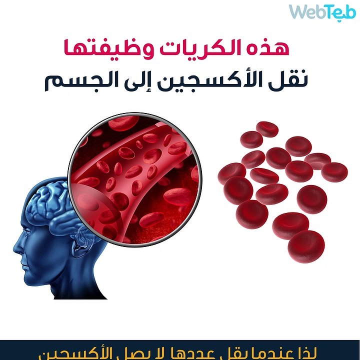 ماذا تعني الإصابة بفقر الدم