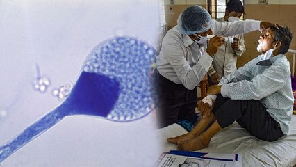 Black Fungus के बारे में फैले कई Rumours, कही आप भी तो नहीं मान रहे सच । Boldsky