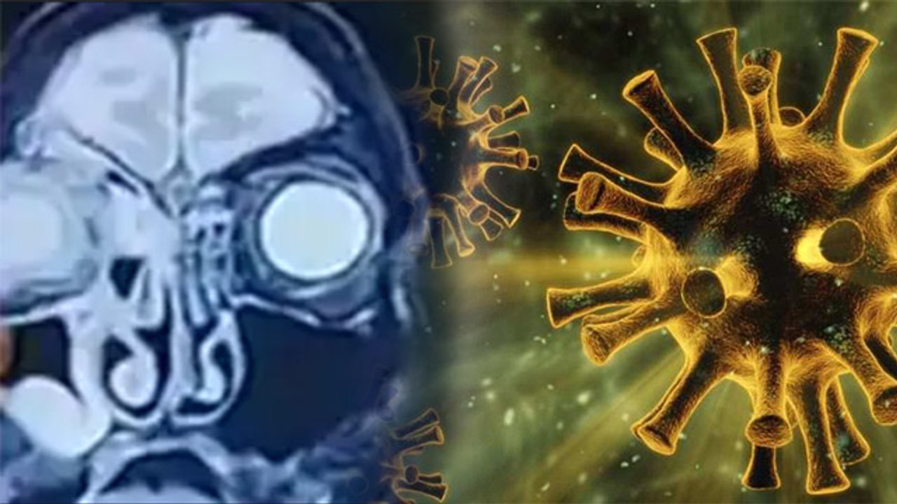 Black Fungus के दो नए Variants आए सामने, इस तरह से कर रहे हैं हमला | Boldsky