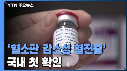 '혈소판 감소성 혈전증' 국내 첫 발생..."AZ 백신 맞은 30대" / YTN