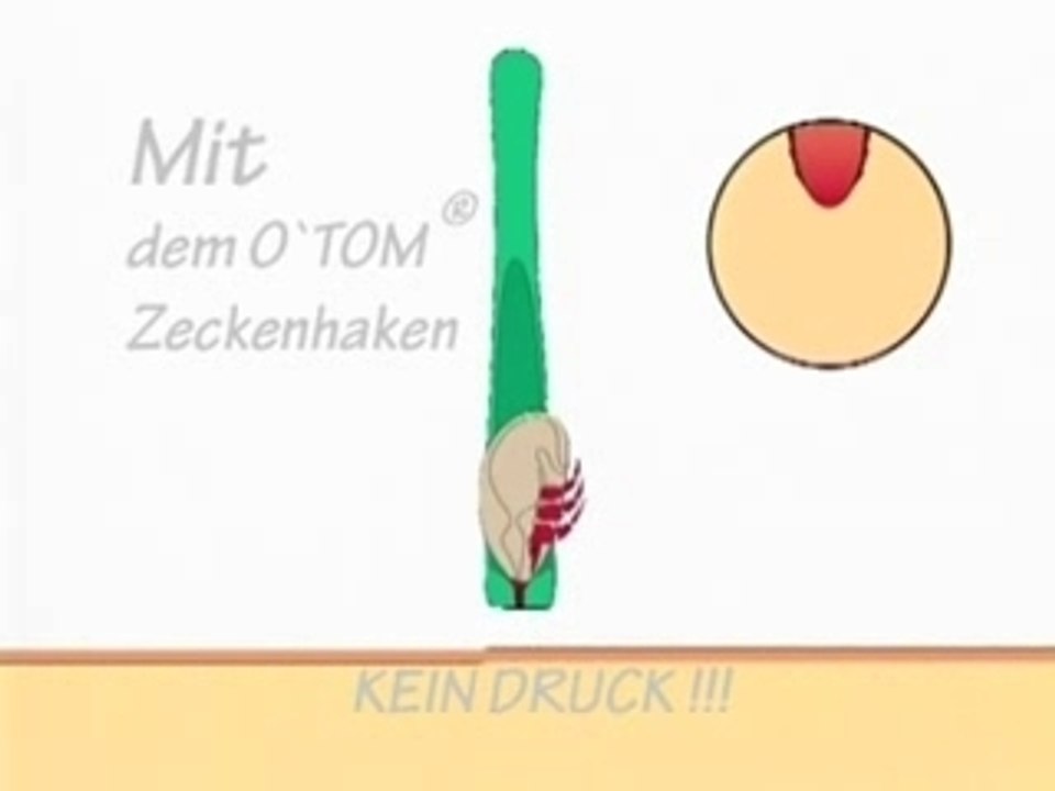 Clip O'TOM Zeckenhaken