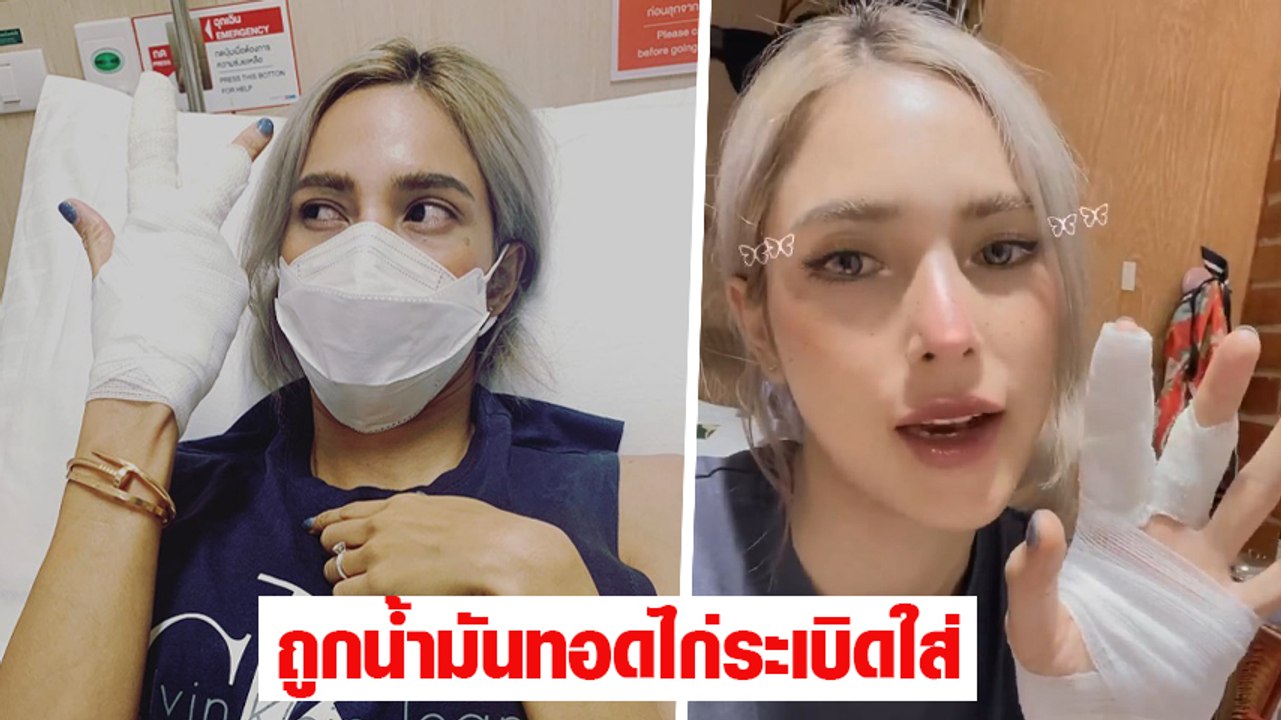 อุ้ม ลักขณา เล่านาทีระทึกเหตุเกิดจากเข้าครัวทำอ...
