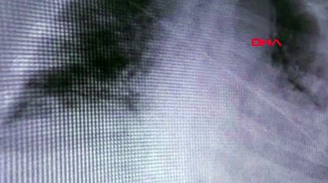 ABD'de geliştirilen yapay zeka öksürük sesiyle koronavirüslü hastayı böyle tespit etti