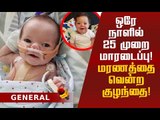 17 அறுவை சிகிச்சைகள்...40 மருத்துவர்கள்! போராடிய குழந்தை!