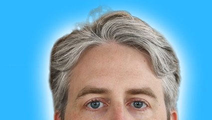 We asked a dermatologist why hair goes gray, and why some experience the shift as early as their 20s