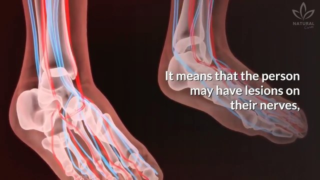 10 Early Signs of Diabetes You Shouldn't Ignore