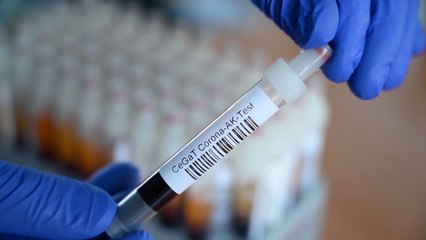 La pandemia se acerca a los 50,5 millones de casos en todo el mundo