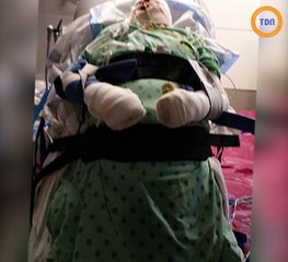 Cette femme a survécu à ses brûlures : cette épreuve l'a rendue plus forte