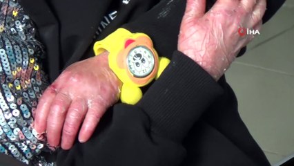 Diyarbakır'daki dernek, kelebek hastası çocukların bakımına 1 yılda 850 bin lira harcadı