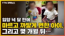 [자막뉴스] 넉 달 만에 마르고 까맣게 변한 아이, 그리고 몇 개월 뒤... / YTN