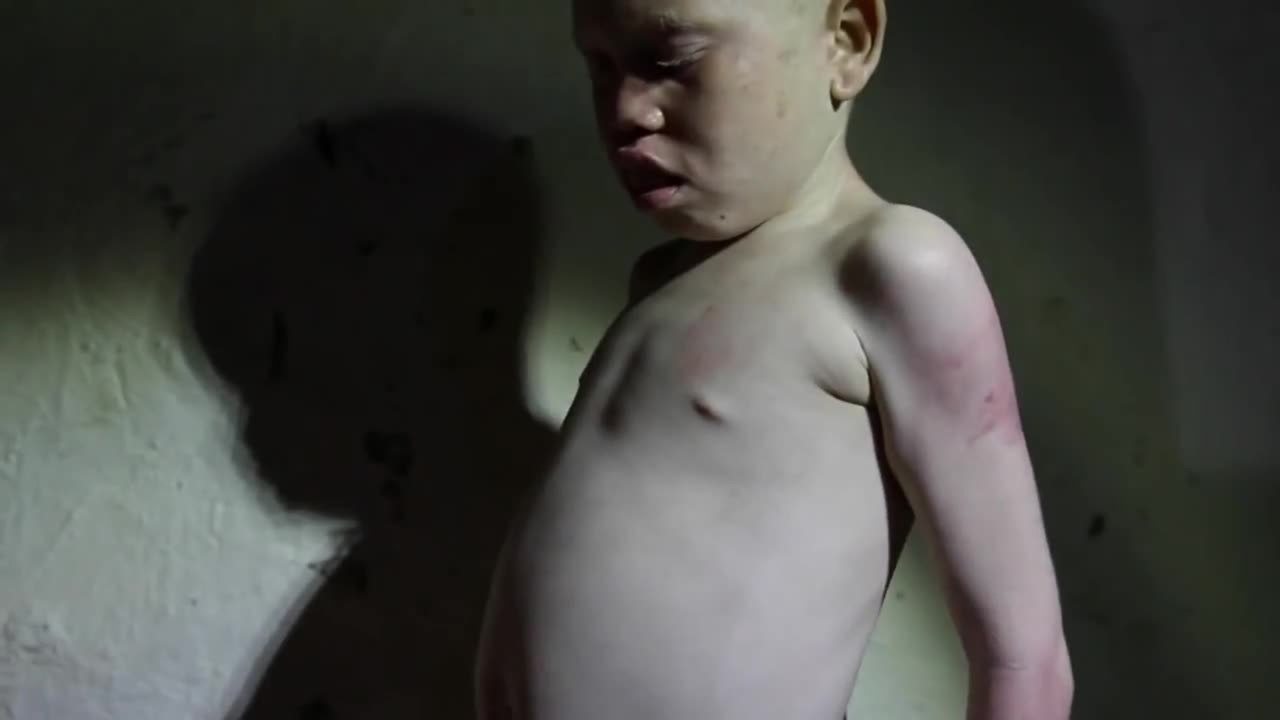 White Shadow - Trailer (Deutsch) HD