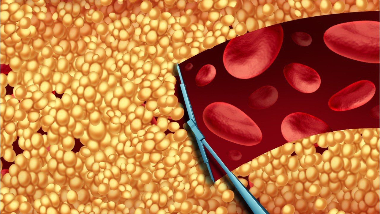 Study: Statins Deliver More Bang For The Buck I...