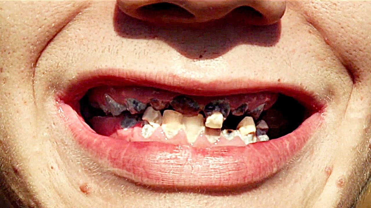 Voll verzuckert That Sugar Film - Trailer (Deutsch) HD