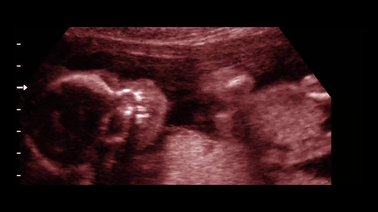 Ma Ma - Clip 05 Magdas Wunsch erfÃ¼llt sich (Deutsch) HD