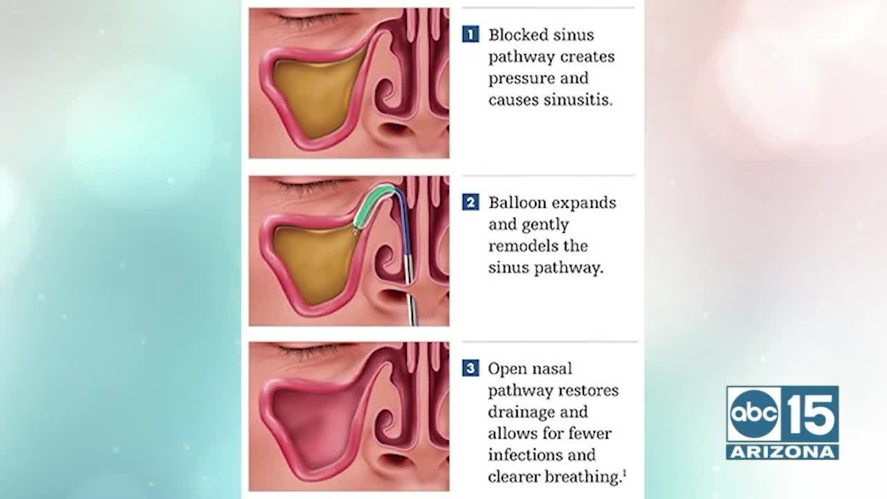 Sinus and Allergy Wellness Center offers altern...