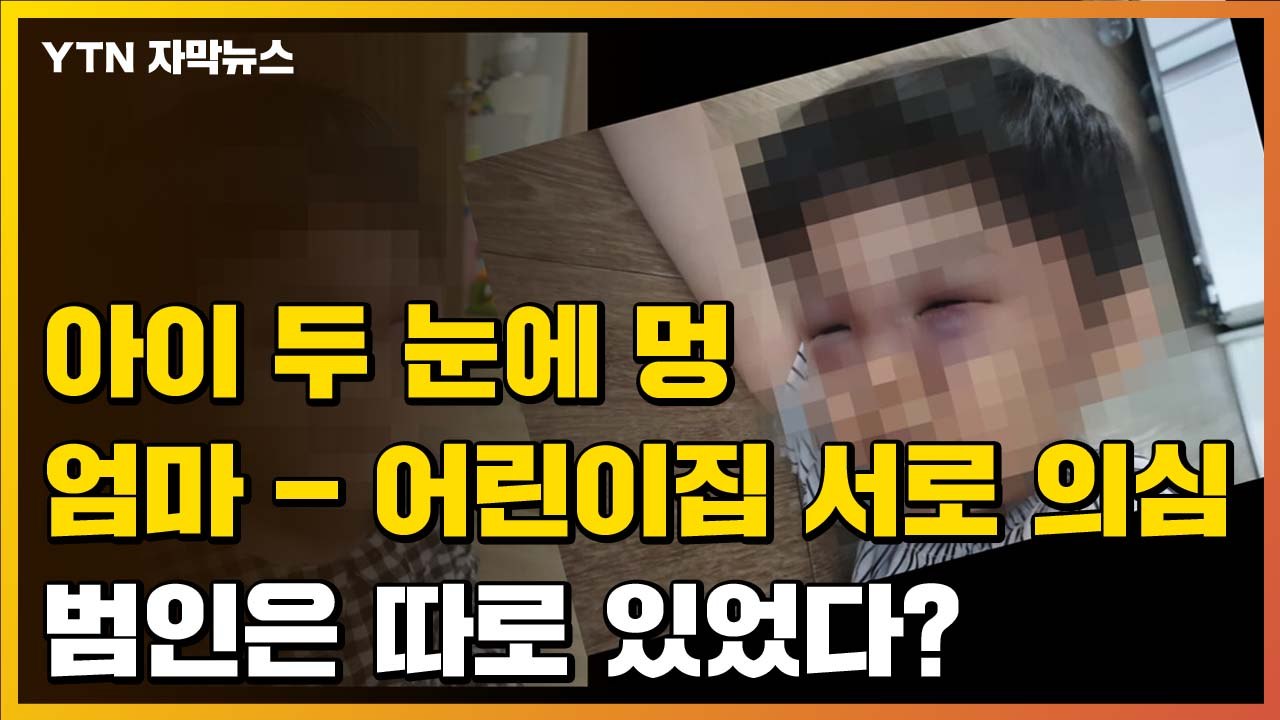 [자막뉴스] "아이 두 눈에 멍" 엄마-어린이집 서로 의심...충격적인 범인의 정체...