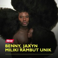 Harlem, Jaxyn miliki rambut unik