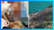 Ikan hidup masuk dan tersangkut di tenggorokan nelayan - TomoNews