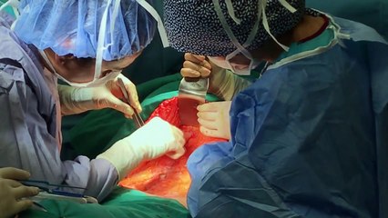 Liposuction ile vücut şekillendirme nasıl yapılır?