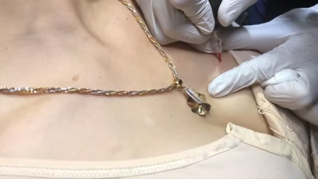 ĐIỂM NÓNG 24H | Xăm nốt ruồi tài lộc hay rước họa vào thân - cảnh giác trộm cướp hiên ngang